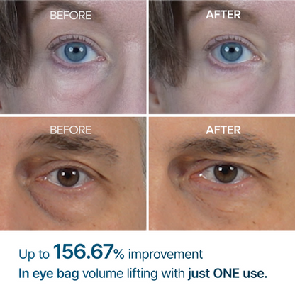 Dr Melaxin Eyephalt Eye Bag Cream